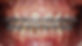 ortodoncia convencional_edited.jpg
