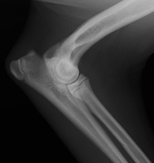 Loki thomas R lat elbow0000_edited_edited.jpg