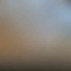 Cedar pergola weathering to natural silver patina