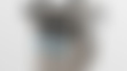 9つのプルーブ紹介☆第1回はRF(ラジオ波)