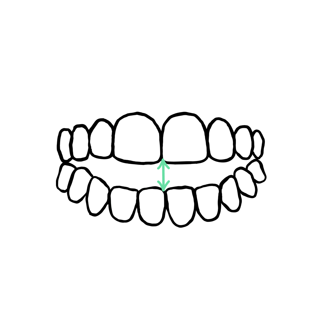 MZR-TWOFRONT-GIF.gif