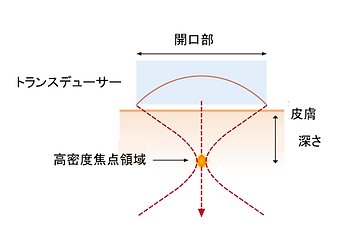開口部大.PNG