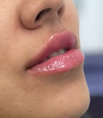 videoframe_3511.png