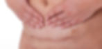 Post-Surgery Lymphatic Drainage