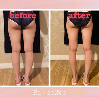 温エステWINBACKで理想の美脚へ