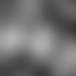 Corinthians x Vasco no Brasileirão 2025: onde assistir, desfalques, escalações e arbitragem