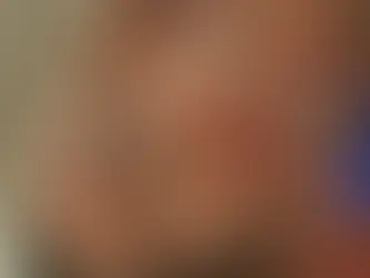 Why Everyone Is Talking About Rejuran Right Now