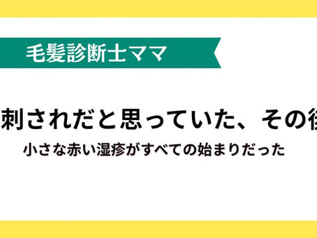 #1｜娘の頭皮に起きた、最初の異変