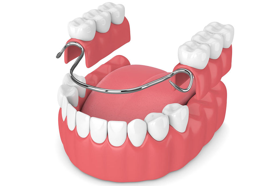 protesis_dental_cuerpo.jpg