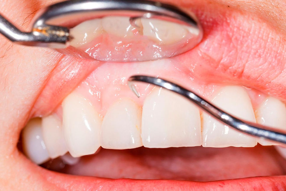 periodoncia 2.jpg