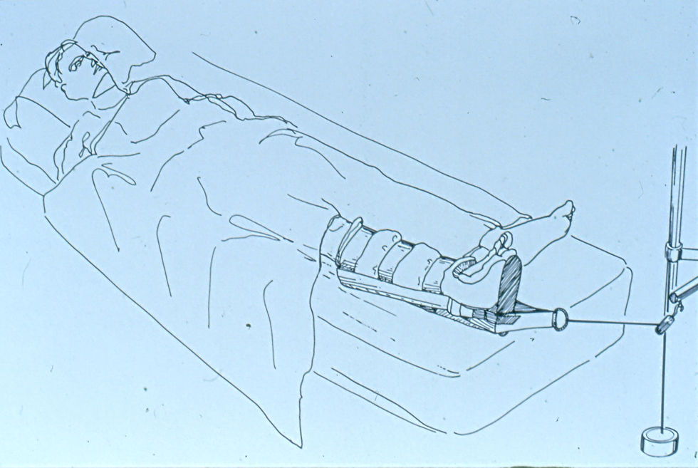 Leg Traction