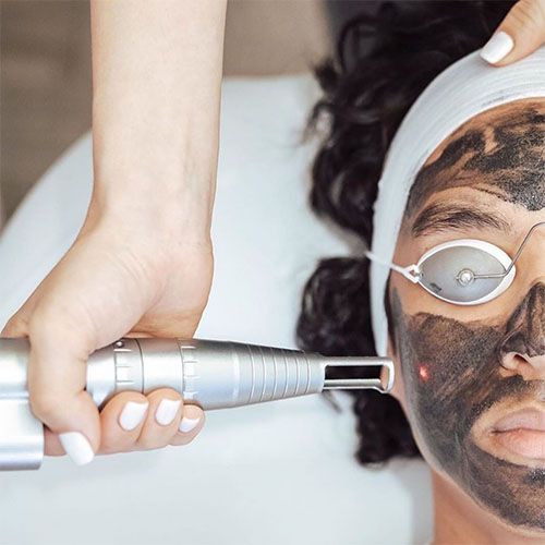 Carbon Laser Facial Bespoke Facial Clinic