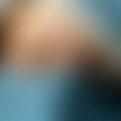 Natural Remedies for Dark Circles and Puffy Eyes