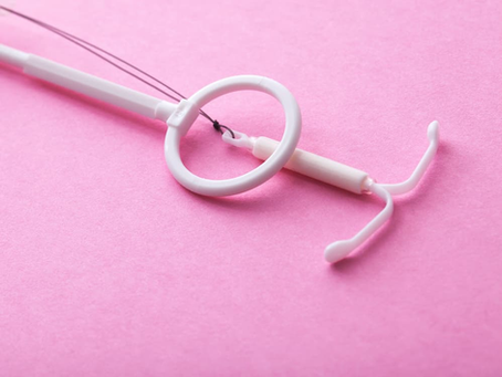 IUD Insertion & Tampon Use: Expert Safety Checklist