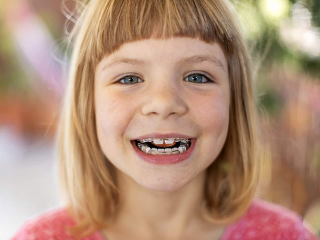 What the Science Says About Lisp and Braces
