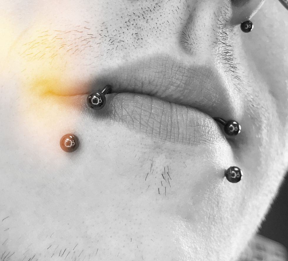 SNAKE BITES