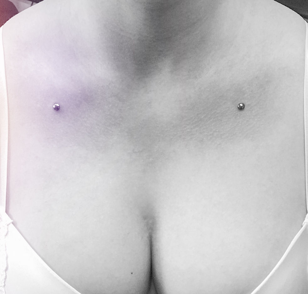 CLAVICLE