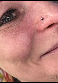 tragus, vertical tragus, f-skin, freaky skin, kartuzy, tatuaż, piercing, top 100 of poland, florida, piercing bible, sanepid, stowarzyszenie polskich piercerów, professional piercers poland, kolczyk, przekłucie, ucho, biżuteria, conch, lobe, industrial, helix, rook, septum, nostril, smiley, paoli, piercing, przekłuwanie, kolczyki, tytan, tatuaż, studio, Kartuzy, nostril, nos