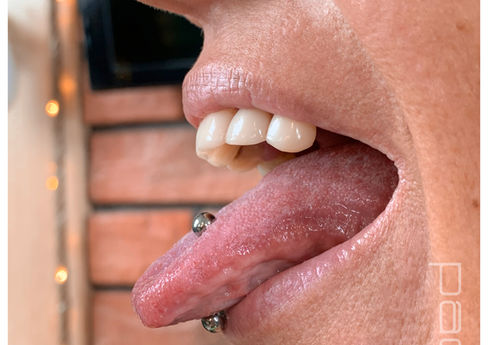 laboratorium piercingu, kolczyk w języku, przekłucie języka, piercing języka, kolczyk do języka, wygojony piercing, piercing dekoracyjny