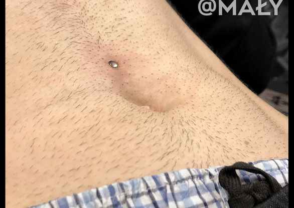 tragus, vertical tragus, f-skin, freaky skin, kartuzy, tatuaż, piercing, top 100 of poland, florida, piercing bible, sanepid, stowarzyszenie polskich piercerów, professional piercers poland, kolczyk, przekłucie, ucho, biżuteria, conch, lobe, industrial, helix, rook, septum, nostril, smiley, paoli, piercing, przekłuwanie, kolczyki, tytan, tatuaż, studio, Kartuzy, microdermal, dermal anchor, F-Skin, paoli, niemały, Kaszuby, Sierakowice, Stowarzyszenie Polskich Piercerów, Polish Piercers' Association