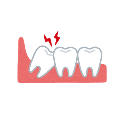 wisdom teeth removal nicholasville ky
