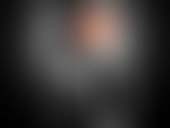 Knee Pain After Running: Causes, Treatment, and When to See a Doctor