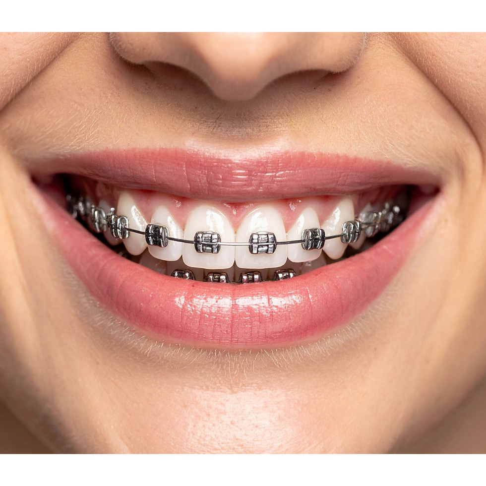 Orthodontics | Midline Dental Care | Dental Clinic | Guwahati