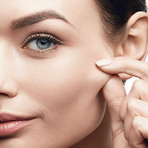 Morpheus8 skin tightening and lift