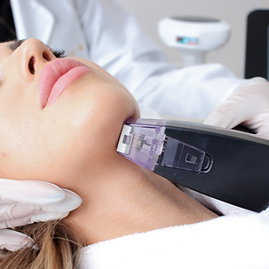 Morpheus8 skin rejuvenation 