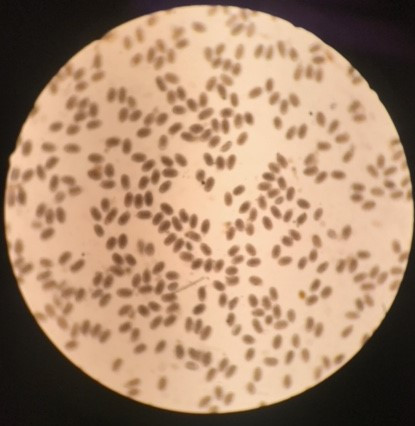 Haemonchus eggs in a fecal sample