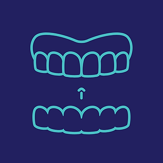 Illustration of a clear aligner