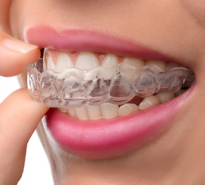 How to Begin Your Smile Transformation With Orthodontic Treatment
