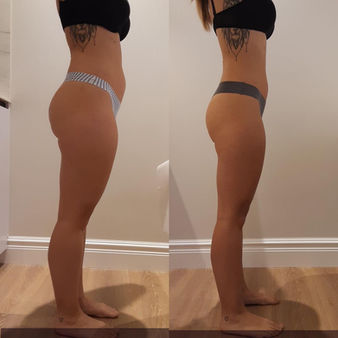 bodyter antes despue lado.jpeg