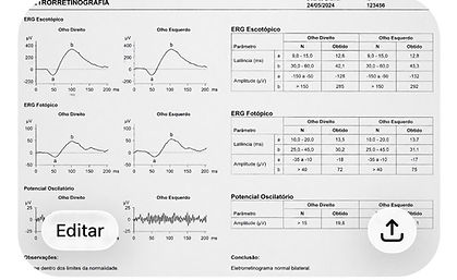 eletroretinografia flavio retina.jpg