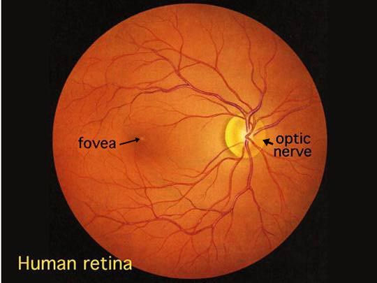 fundo de olho flavio retina 2.jpg