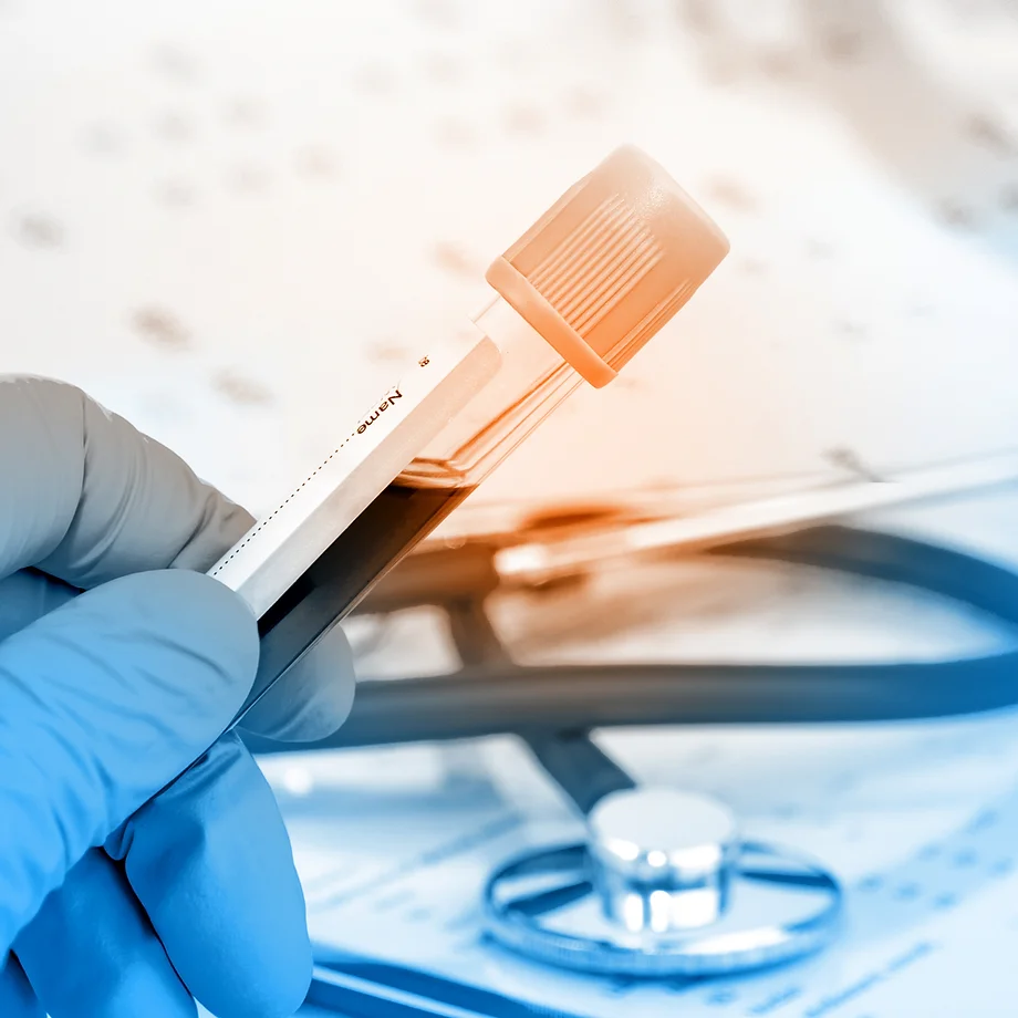 Blood Test.webp