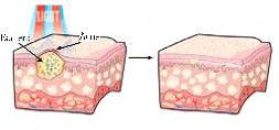 img4_1_3.gif