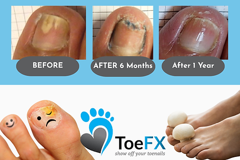 toefx3.png