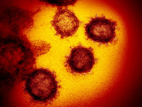 Chụp được ảnh virus Covid-19 ở độ phân giải nguyên tử.