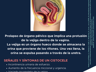 CISTOCELE