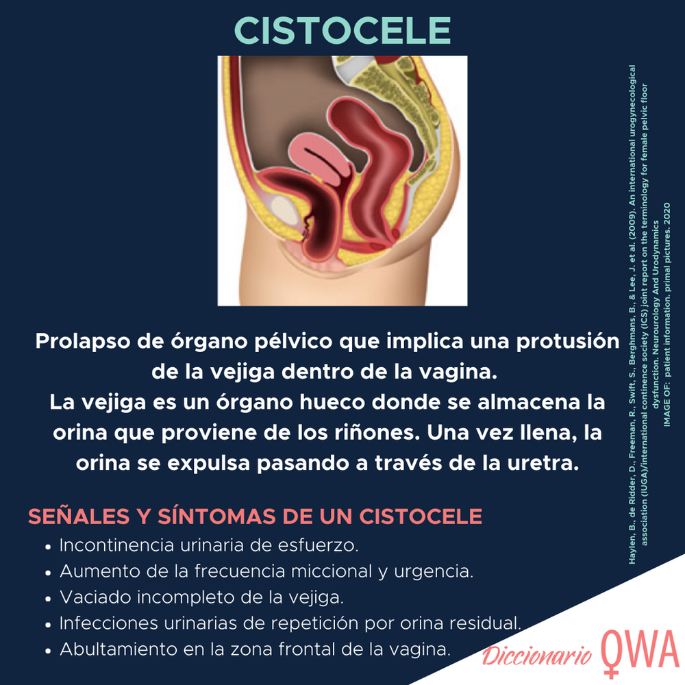 CISTOCELE