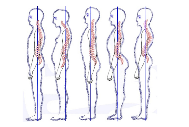 HowtoImproveYourPosture-de
