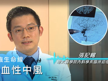 缺血性中风 | TVB 最强生命线