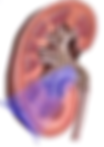 Lithotripsy