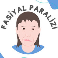 FASİYAL PARALİZİ