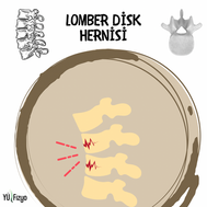 LOMBER DİSK HERNİSİ