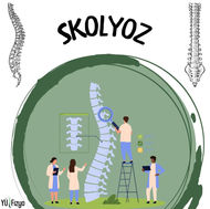 SKOLYOZ