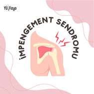 İMPENGEMENT SENDROMU