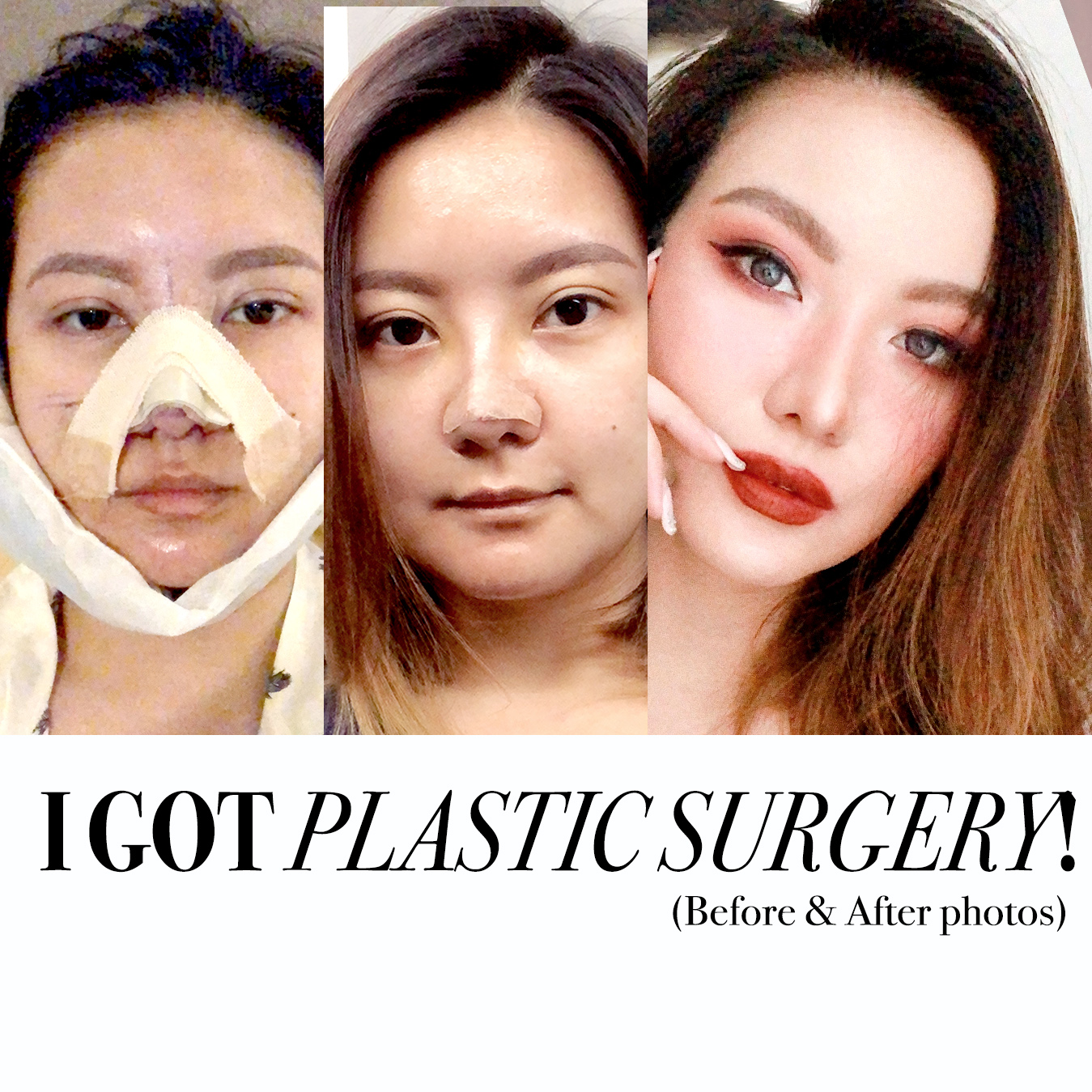 Elayna Carausu Plastic Surgery