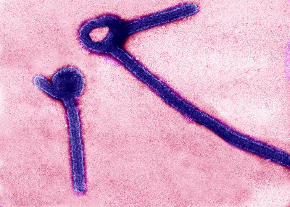 US puts its focus on keeping Ebola cases out of the country
